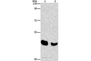 Western blot analysis of Human normal liver and mouse pancreas tissue, using BAAT Polyclonal Antibody at dilution of 1:650 (BAAT Antikörper)