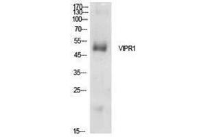Western Blotting (WB) image for anti-Vasoactive Intestinal Peptide Receptor 1 (VIPR1) (Internal Region) antibody (ABIN3178920) (VIPR1 Antikörper  (Internal Region))