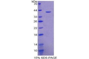 SDS-PAGE (SDS) image for Neuropeptide Y (NPY) (AA 30-97) protein (His tag,GST tag) (ABIN2123387) (NPY Protein (AA 30-97) (His tag,GST tag))