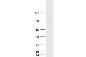Western Blotting (WB) image for 3'-phosphoadenosine 5'-phosphosulfate Synthase 2 (PAPSS2) (Transcript Variant 1) protein (Myc-DYKDDDDK Tag) (ABIN2728220)