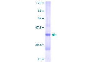 Image no. 1 for Crystallin, Zeta, Homolog (AA 1-113) protein (GST tag) (ABIN1350467) (CRYZL1 Protein (AA 1-113) (GST tag))