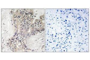 Immunohistochemistry (IHC) image for anti-beta 1,3-Galactosyltransferase-Like (B3GALTL) (C-Term) antibody (ABIN1850901) (B3GALTL Antikörper  (C-Term))