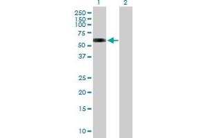 Western Blot analysis of MAP3K7IP1 expression in transfected 293T cell line by MAP3K7IP1 MaxPab polyclonal antibody. (TAB1 Antikörper  (AA 1-504))
