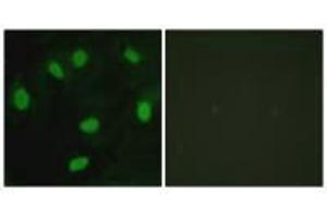 Immunofluorescence analysis of HeLa cells, using TBX15/18 antibody. (T-Box 15 Antikörper)