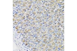 Immunohistochemistry of paraffin-embedded mouse stomach using CBR3 antibody (ABIN5975603) at dilution of 1/100 (40x lens). (CBR3 Antikörper)