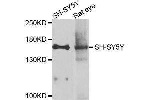Western blot analysis of extracts of various cells, using ADCY2 antibody. (ADCY2 Antikörper)