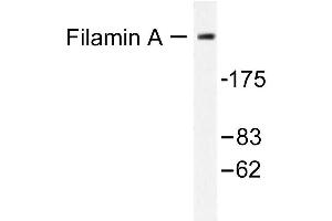 Image no. 1 for anti-Filamin A, alpha (FLNA) antibody (ABIN265421) (Filamin A Antikörper)