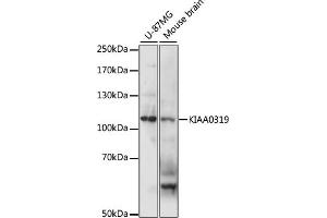 Western blot analysis of extracts of various cell lines, using KI antibody (ABIN7268112) at 1:1000 dilution. (KIAA0319 Antikörper  (AA 21-300))