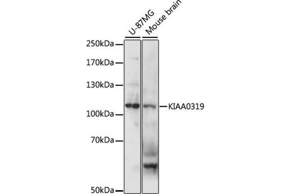 KIAA0319 Antikörper  (AA 21-300)