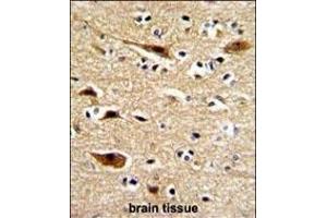 Formalin-fixed and paraffin-embedded human brain with P Antibody (N-term), which was peroxidase-conjugated to the secondary antibody, followed by DAB staining. (APP Antikörper  (N-Term))