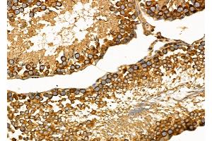 ABIN6260554 and ABIN6272679 at 1/100 staining Rat testis tissue by IHC-P. (CCR10 Antikörper  (C-Term))