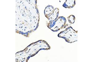 Immunohistochemistry of paraffin-embedded human placenta using LNPEP Rabbit pAb (ABIN6129286, ABIN6143284, ABIN6143285 and ABIN6215523) at dilution of 1:100 (40x lens). (LNPEP Antikörper  (AA 1-110))