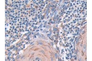 Immunohistochemistry (IHC) image for anti-Superoxide Dismutase 2, Mitochondrial (SOD2) (AA 25-222) antibody (ABIN7442672)
