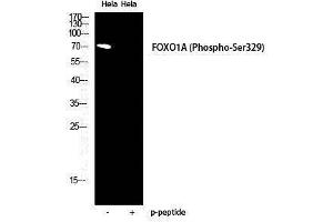 Western Blotting (WB) image for anti-Forkhead Box O1 (FOXO1) (pSer329) antibody (ABIN3173231) (FOXO1 Antikörper  (pSer329))