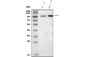 Western blot analysis of PDE6 beta/PDE6B using anti-PDE6 beta/PDE6B antibody (ABIN7600893).