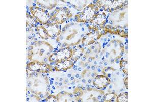 Immunohistochemistry of paraffin-embedded mouse kidney using PEX5 antibody (ABIN5973402) at dilution of 1/100 (40x lens). (PEX5 Antikörper)