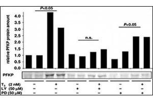 Image no. 2 for anti-phosphofructokinase, Platelet (PFKP) (C-Term) antibody (ABIN6749803) (PFKP Antikörper  (C-Term))