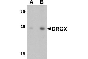 Western blot analysis of DRGX in rat liver tissue lysate with DRGX antibody at (A) 1 and (B) 2 µg/mL. (DRGX Antikörper  (C-Term))