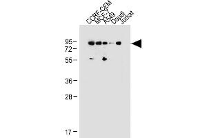 All lanes : Anti-MDM2 Antibody (C-term) at 1:1000 dilution Lane 1: CCRF-CEM whole cell lysate Lane 2: MCF-7 whole cell lysate Lane 3: A549 whole cell lysate Lane 4: Daudi whole cell lysate Lane 5: Jurkat whole cell lysate Lysates/proteins at 20 μg per lane.