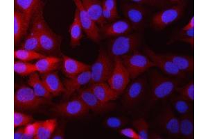 IF analysis of NQO1 using anti-NQO1 antibody (ABIN7599200). (NQO1 Antikörper  (AA 1-274))
