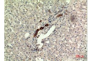 Immunohistochemistry (IHC) analysis of paraffin-embedded Human Liver, antibody was diluted at 1:100. (IFN omega (C-Term) Antikörper)