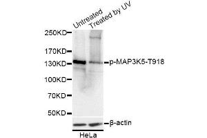 Western blot analysis of extracts of HeLa cells, using Phospho-MAP3K5-T918 antibody. (ASK1 Antikörper  (pThr918))