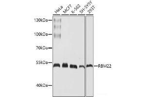 Western blot analysis of extracts of various cell lines using RBM22 Polyclonal Antibody at dilution of 1:1000. (RBM22 Antikörper)