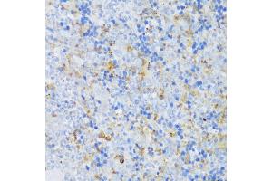 Immunohistochemistry (IHC) image for anti-EF-Hand Calcium Binding Domain 4B (EFCAB4B) (AA 1-200) antibody (ABIN6138999)
