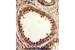 Immunohistochemistry (IHC) image for anti-Protein tyrosine Phosphatase Type IVA, Member 2 (PTP4A2) antibody (ABIN3002826) (PTP4A2 Antikörper)