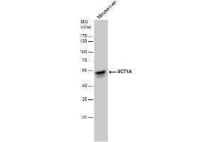 WB Image UGT1A antibody detects UGT1A protein by western blot analysis. (Ugt1 Antikörper)