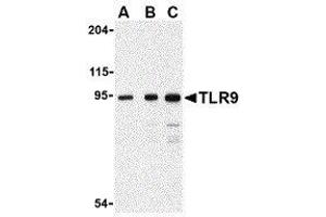 Western Blotting (WB) image for anti-Toll-Like Receptor 9 (TLR9) (Center) antibody (ABIN2479768)