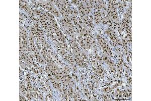 IHC analysis of XRCC4 using anti-XRCC4 antibody (ABIN7599168).