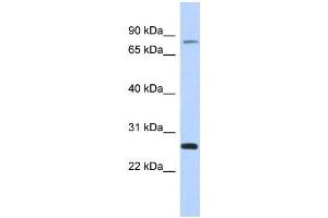 WB Suggested Anti-ZSCAN2 Antibody Titration:  0. (ZSCAN2 Antikörper  (Middle Region))