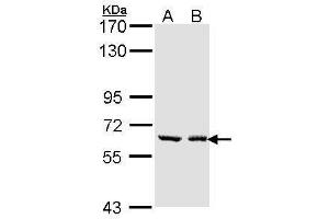 UGT1A6 Antikörper  (Center)
