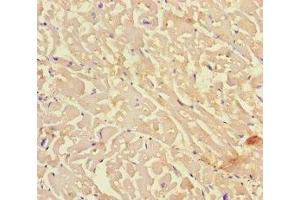 Immunohistochemistry of paraffin-embedded human heart tissue using ABIN7157632 at dilution of 1:100