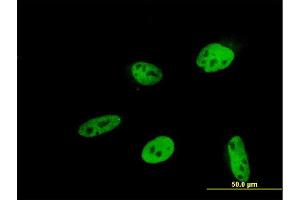 Immunofluorescence of monoclonal antibody to HEYL on HeLa cell. (HEYL Antikörper  (AA 221-327))