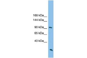 WB Suggested Anti-ARHGAP30 Antibody Titration: 0.