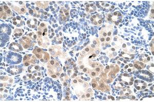Human kidney (SLC25A45 Antikörper  (C-Term))