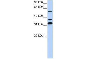 WB Suggested Anti-TRIM9 Antibody Titration:  0. (TRIM9 Antikörper  (C-Term))