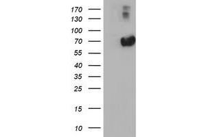 HEK293T cells were transfected with the pCMV6-ENTRY control (Left lane) or pCMV6-ENTRY AFP (Right lane) cDNA for 48 hrs and lysed. (alpha Fetoprotein Antikörper)