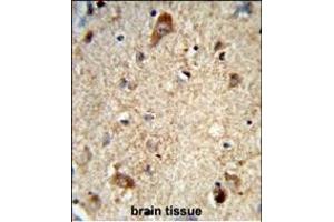Formalin-fixed and paraffin-embedded human brain tissue reacted with DAB1 Antibody (Center), which was peroxidase-conjugated to the secondary antibody, followed by DAB staining. (DAB1 Antikörper  (AA 189-216))