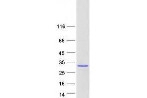 Validation with Western Blot