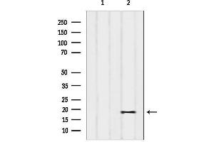 Western blot analysis of lysates from Cos-7, using PIGP Antibody.