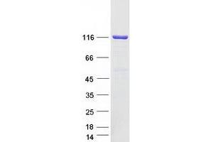 Validation with Western Blot (PC Protein (Transcript Variant 3) (Myc-DYKDDDDK Tag))