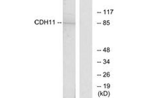 Western blot analysis of extracts from Jurkat cells, using CDH11 Antibody. (OB Cadherin Antikörper  (AA 421-470))