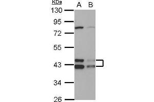 WB Image Sample (30 ug of whole cell lysate) A: HepG2 B: HCT116 10% SDS PAGE antibody diluted at 1:1000 (DNAJA3 Antikörper  (Center))