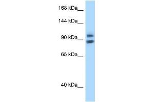 WB Suggested Anti-ZHX1 Antibody Titration: 1. (ZHX1 Antikörper  (N-Term))