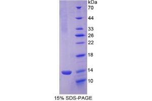 SDS-PAGE of Protein Standard from the Kit (Highly purified E. (PF4 CLIA Kit)