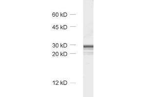 dilution: 1 : 1000, sample: synaptosomal fraction (P2) of rat brain
