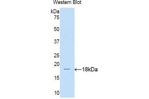 Western blot analysis of the recombinant protein. (IL17RA Antikörper  (AA 33-172))